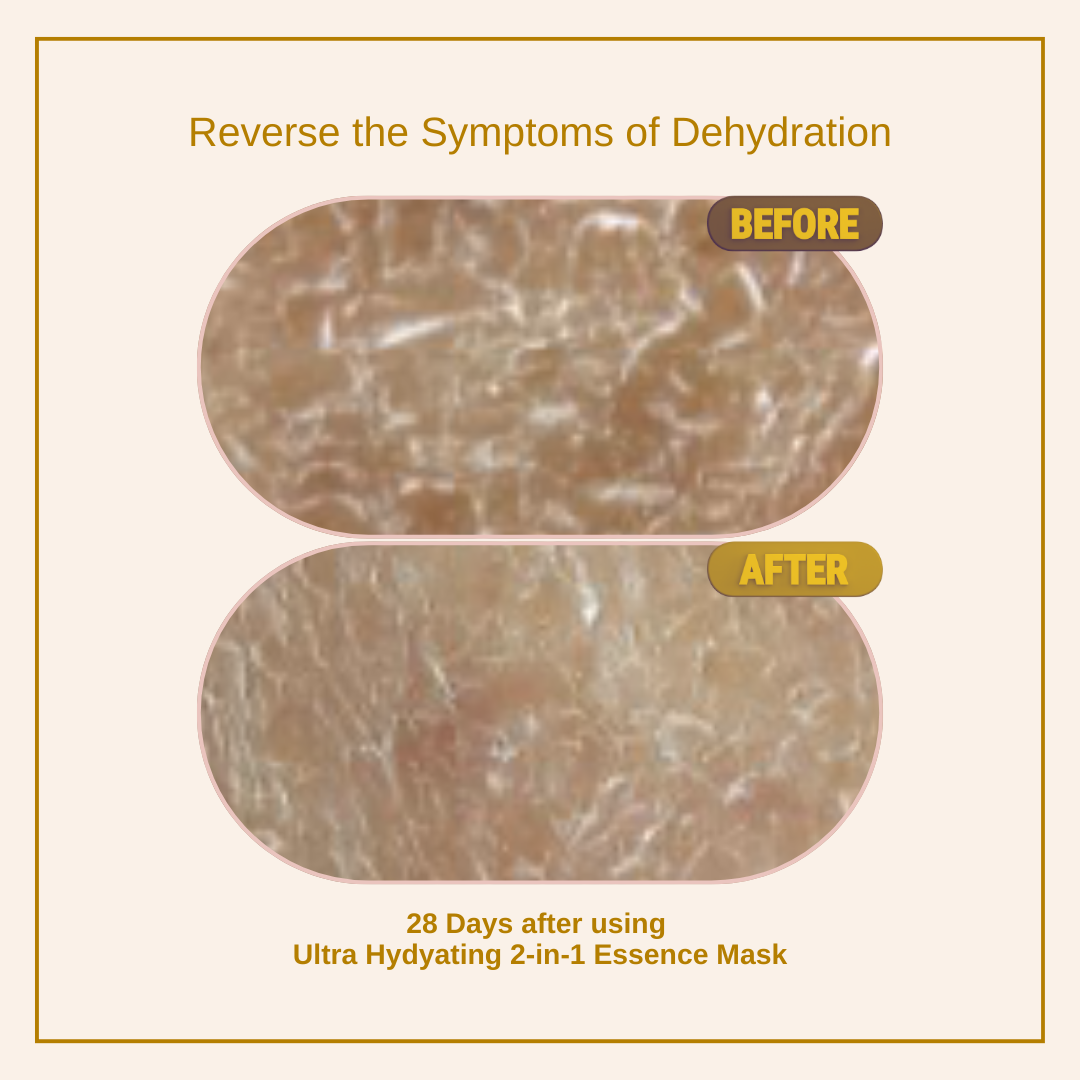 Ultra-Hydrating Essence