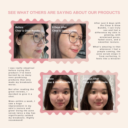 Ultimate Glow Bundle